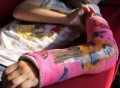 Children Cast Tattoo