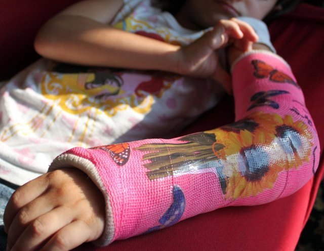 Children Cast Tattoo