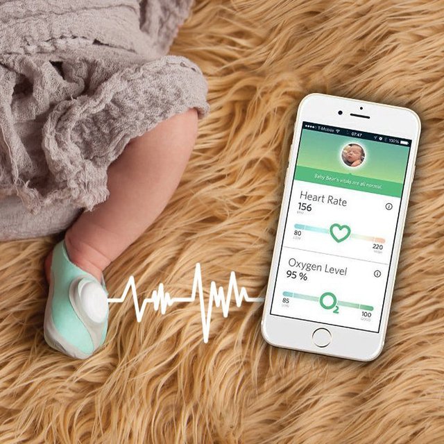 Owlet Baby Vital Signs Monitor